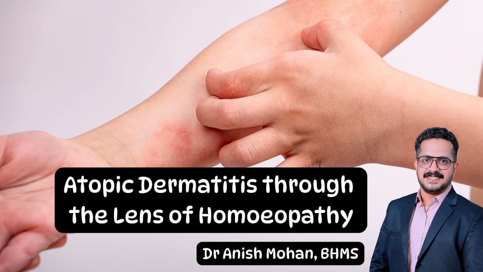Revisiting Atopic Dermatitis through the Lens of Homoeopathy: An Evidence-Informed Perspective